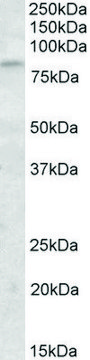Anti-KLHL6 antibody produced in goat