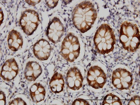 Monoclonal Anti-AKR1B10 antibody produced in