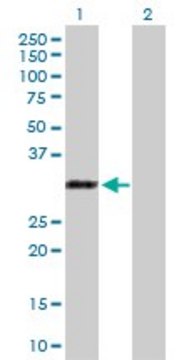 Anti-RYBP antibody produced in rabbit