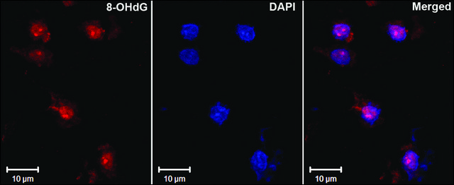 Monoclonal Anti-DNA/RNA Damage antibody produced