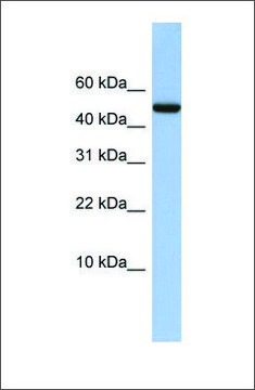 Anti-ABAT antibody produced in rabbit