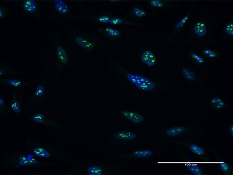 Anti-PES1 antibody produced in mouse