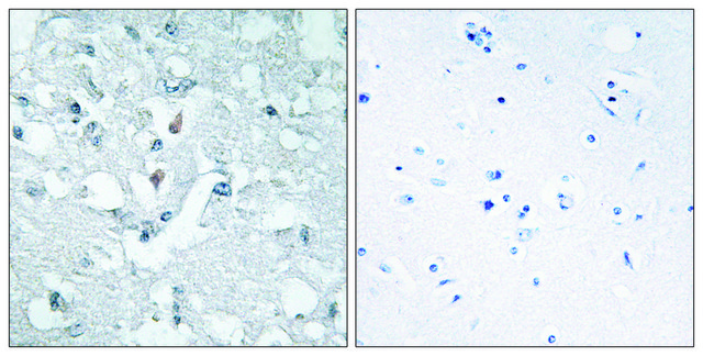 Anti-GLCTK antibody produced in rabbit
