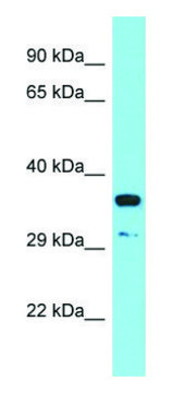 Anti-RSPO3 (C-terminal) antibody produced in