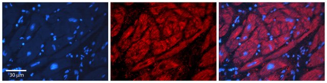 Anti-ADH1B antibody produced in rabbit