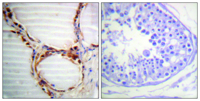 Anti-MCM4 antibody produced in rabbit