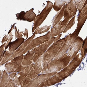Anti-ST6GALNAC3 antibody produced in rabbit