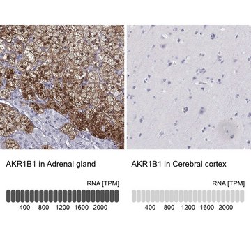 Anti-AKR1B1 antibody produced in rabbit