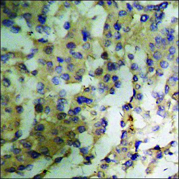 Anti-phospho-PKC ? (pThr?¹?) antibody produced
