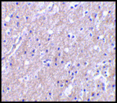 Anti-CTRP6 antibody produced in rabbit