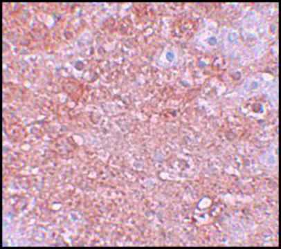 Anti-ZIP12 antibody produced in rabbit