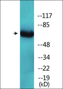 Anti-phospho-Ezrin (pTyr³?³) antibody produced in