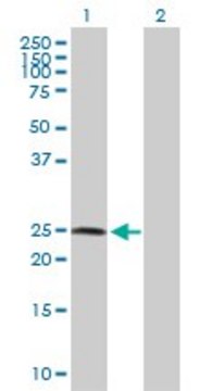 Anti-ZNF313 antibody produced in rabbit