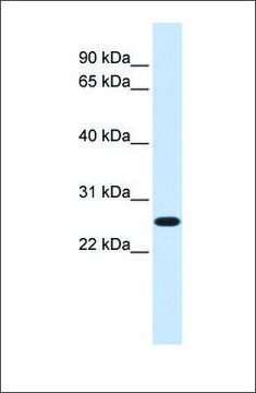 Anti-DULLARD antibody produced in rabbit