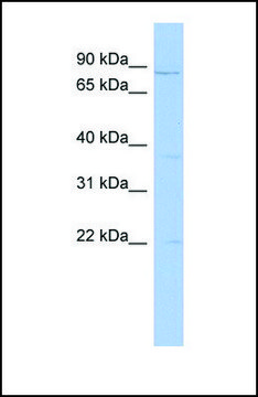 Anti-PCSK4, (N-terminal) antibody produced in