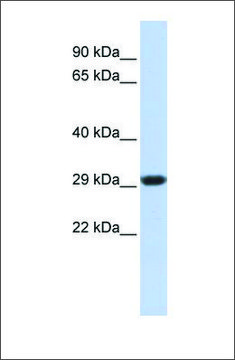Anti-SDHB antibody produced in rabbit