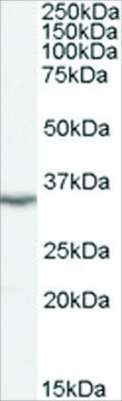 Anti-LASP1, N-Terminal antibody produced in