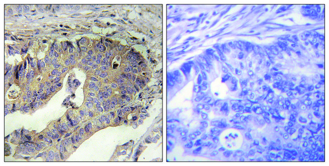 Anti-Fibrillin-1 antibody produced in rabbit
