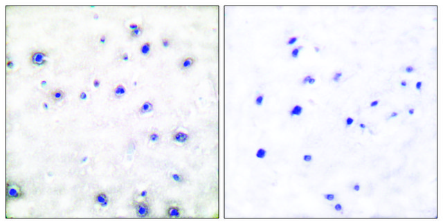 Anti-TRK A antibody produced in