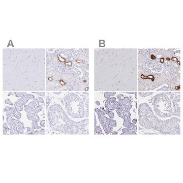 Anti-UMOD antibody produced in rabbit