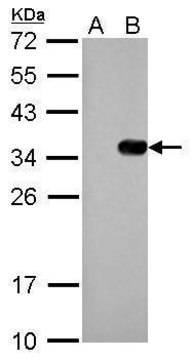 Monoclonal Anti-S Tag antibody produced