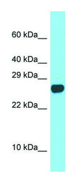 Anti-Spaca3 (C-terminal) antibody produced in