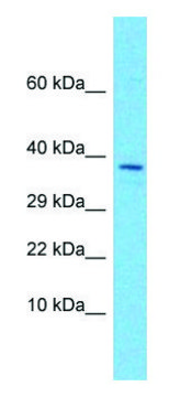Anti-EGFLAM (C-terminal) antibody produced in