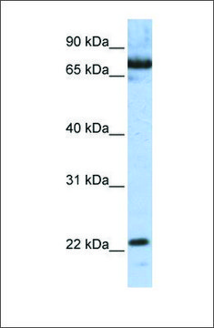 Anti-SCAND1 (ab1) antibody produced in