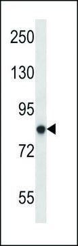 ANTI-MOUSE PRKCA (N-TERM) antibody produced