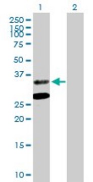 Anti-ASPA antibody produced in mouse