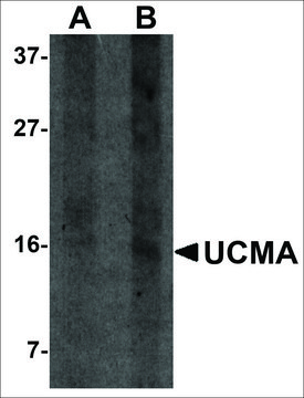 Anti-UCMA antibody produced in rabbit