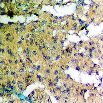 Anti-phospho-FOXO1A/3A (pSer³²²+Ser³²?) antibody produced in