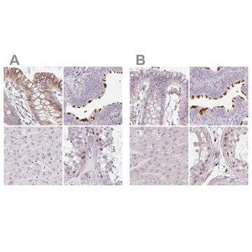 Anti-TMEM237 antibody produced in rabbit