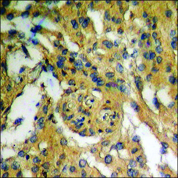 Anti-phospho-IKK-? (pSer¹??) /IKK-? (pSer¹??) antibody