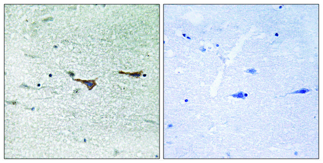 Anti-TOB1 antibody produced in rabbit