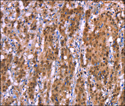Anti-AMER1 antibody produced in rabbit