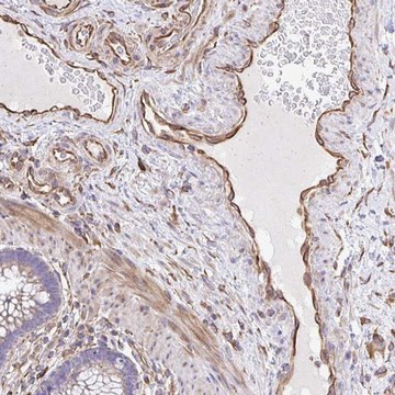 Anti-RNF103 antibody produced in rabbit
