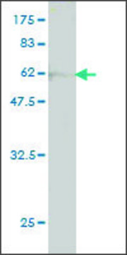 ANTI-FLJ20643 antibody produced in mouse
