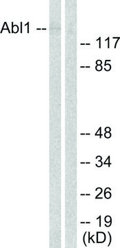 Anti-ABL antibody produced in rabbit