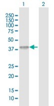 Anti-ACAD8 antibody produced in rabbit