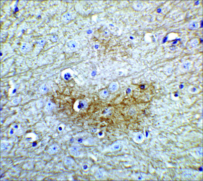 Anti-GLS2 antibody produced in rabbit