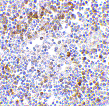Anti-MDA5 antibody produced in rabbit
