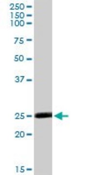 Anti-MSRA antibody produced in rabbit