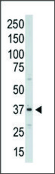 Anti-Aurora-C (C-term) antibody produced in
