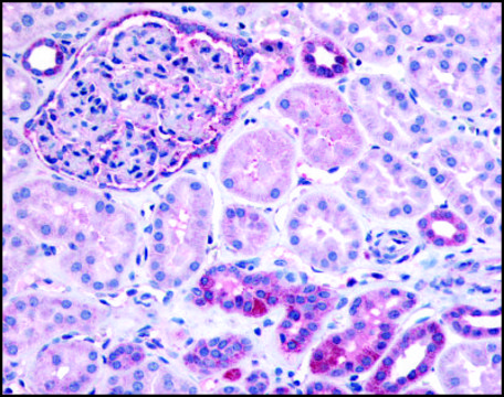 Anti-PIB5PA (AB2) antibody produced in