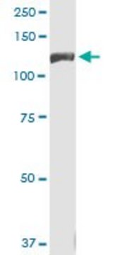 Monoclonal Anti-INSRR antibody produced in