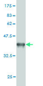 ANTI-GUCY2D antibody produced in mouse