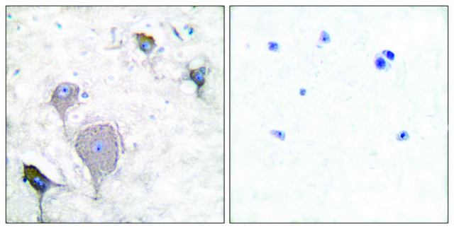 Anti-Peripherin antibody produced in rabbit