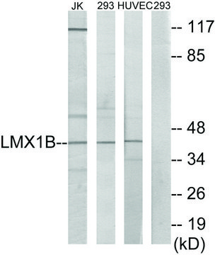 Anti-LMX1B antibody produced in rabbit