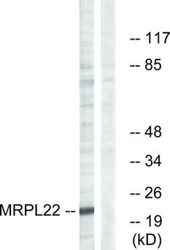 Anti-MRPL22 antibody produced in rabbit